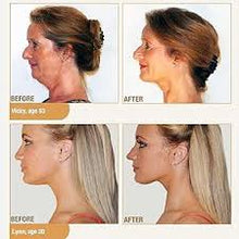 Charger l'image dans la galerie, Neckline Slimmer Menton Minceur - Fini Le Double Menton جهاز شد ترهلات الرقبة و رفع الدقن